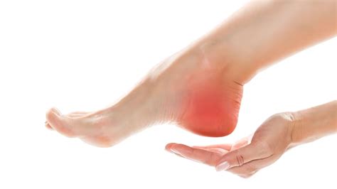 What are the Symptoms of Burning Feet? – NutritionFact.in
