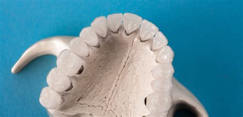 Maxilla: Anatomy, Function, and Clinical Significance
