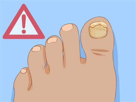 How Long Does Big Toenail Take To Grow Back at Louise Costa blog
