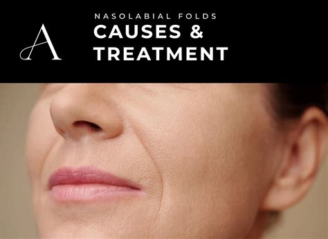 Goodbye Nasolabial Folds | Smile Lines | Treatments | Aesthetics By Stephanie | Livingston ...