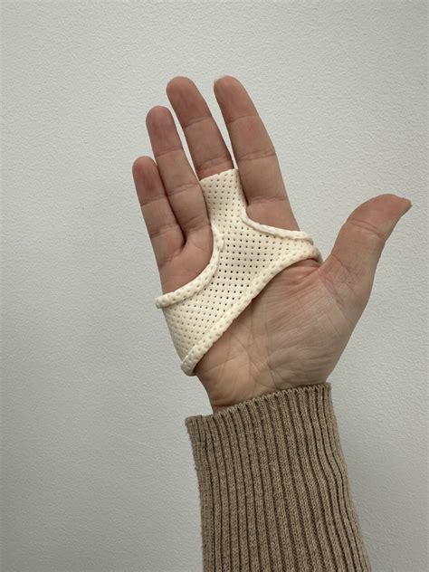 Understanding Trigger Finger: Anatomy, Causes, and Treatment Options - SA Hand Therapy