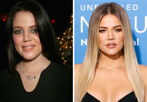 Kardashian Surgery Before And After