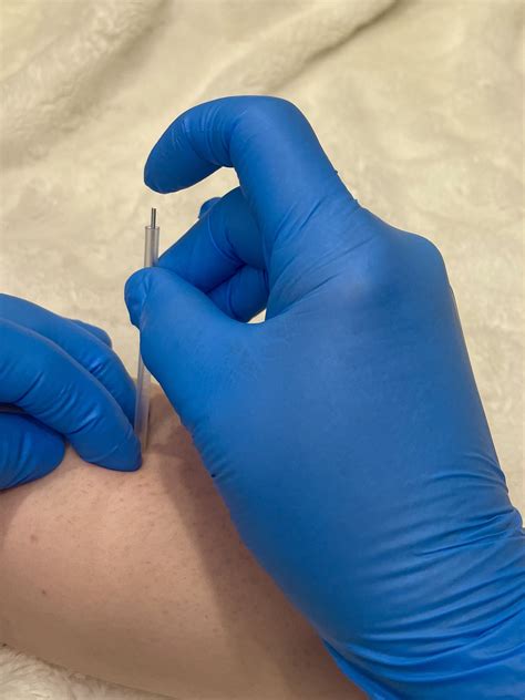 Dry Needling Academy - DNA - Best Dry Needling Courses for PT, OT, AT, DC