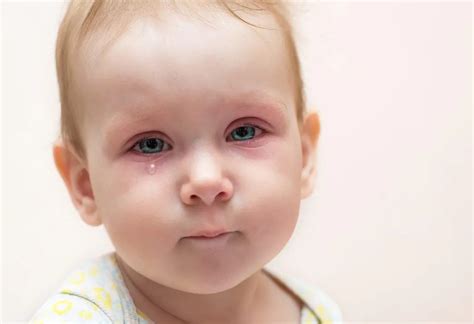 Eye Discharge in Newborn Babies: Causes and Treatment