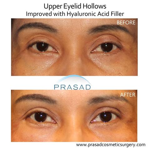 Asymmetrical Eyes Celebrities 60 Photos - Moonagedaydream.film