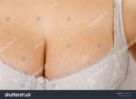 Stretch Marks On Breast White Bra: foto de stock (editar ahora) 1257085357
