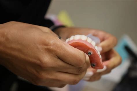 Dental Implant Sizes: Choosing the Right Size for Your Oral Health Needs | Hanna Dental Implant ...