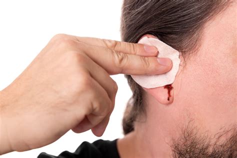 Bleeding Ear: Causes and When to See a Specialist - Coastal Ear, Nose & Throat