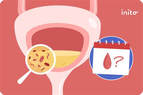 If I Get a UTI, Will It Delay My Period?