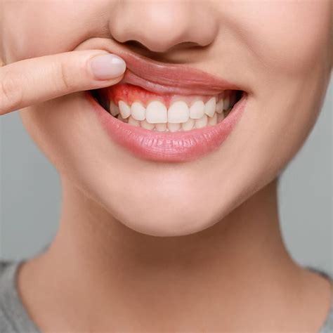 Can gum disease kill you? Know Dangers of Neglecting Gum Health