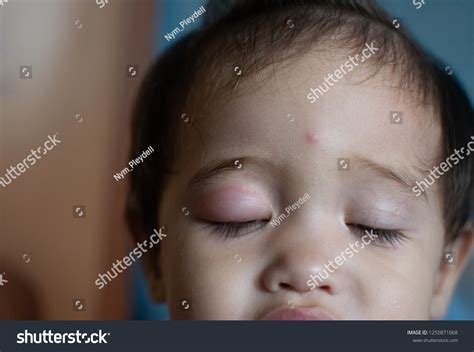 163 Baby Having Eye Problem Images, Stock Photos & Vectors | Shutterstock