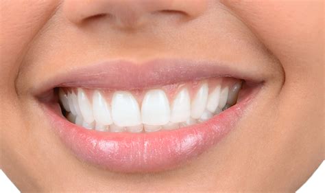 Healthy Bottom Teeth Gums at Loren Bona blog