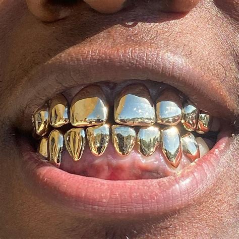 10 Karat Gold Grillz – Tony Tong & Co