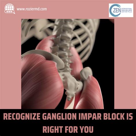 Recognize Ganglion Impar Block Is Right for You In Mansfield, Tx