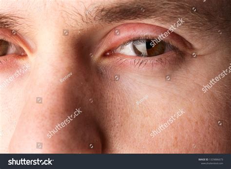5,446 Male Eyelid Images, Stock Photos & Vectors | Shutterstock