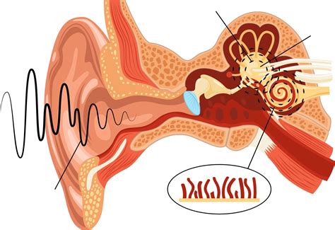 Tinnitus: el zumbido fantasma en los oídos