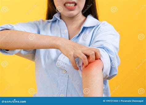 Close Up Person Itchy Facial Expression and Hand Scratch Her Arm Skin ...