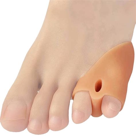 Pinky Toe Bunion Removal