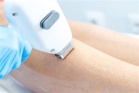 Depilación láser en muslos – Dermasana