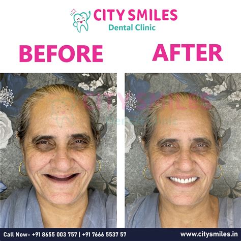 Transform Your Smile at CITY SMILES Dental Clinic – Where Every Smile ...