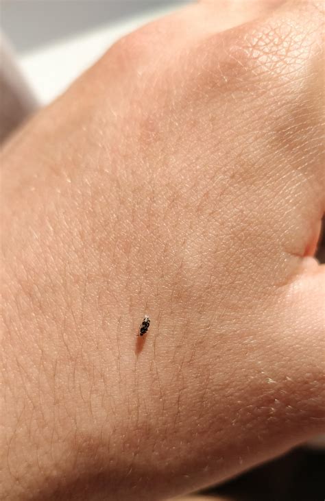 Do Black Carpet Beetles Bite Humans at Douglas Hammond blog