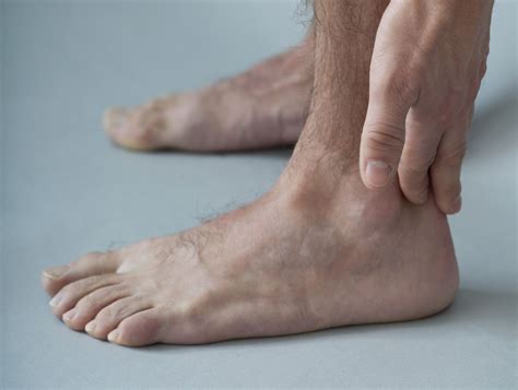 Best Tips About How To Heal Foot Tendonitis - Dugdrive82