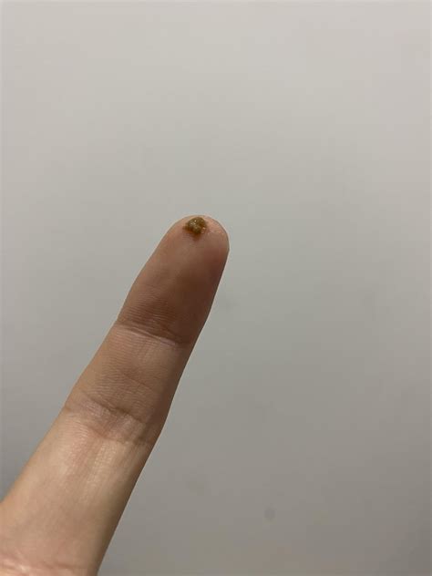 Brown Mucus From Throat