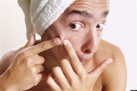 Skintherapy.. Ask the Esthetician: Acne Surgery and Popping Pimples
