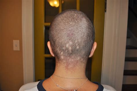 Carri Us Home: Chemo #2 & I'm Losing My Mind...and My Hair!