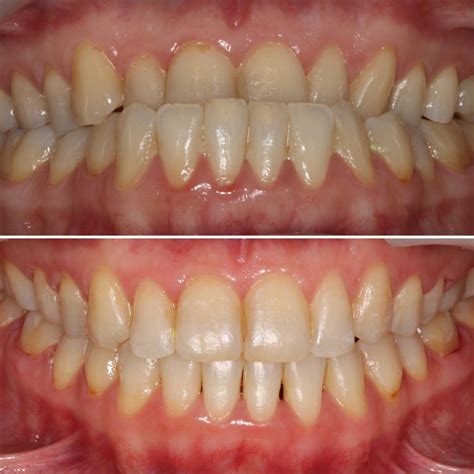 casos clinicos - pmclinicdentalcare.com