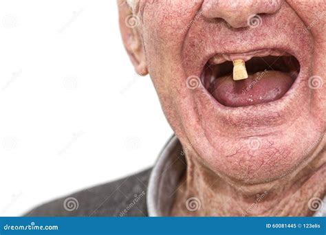 Photo Of Man With No Teeth at Robert Curl blog