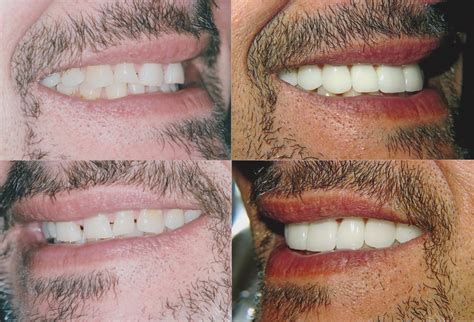 Dental Professionals Of Lincoln Park at Anna Beyers blog