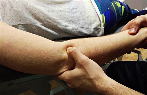 Codo de tenista o epicondilitis lateral, causas y tratamiento - Cranium