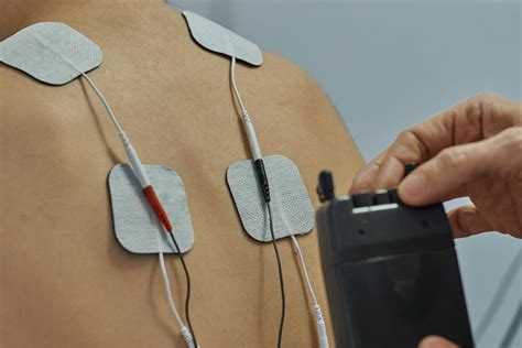 Electrical Stimulation Therapy