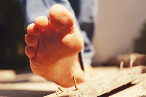 Tetanus (Lockjaw): Symptoms, Causes and Treatments