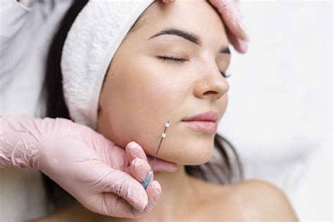 Thread Lift - Biocare Academy