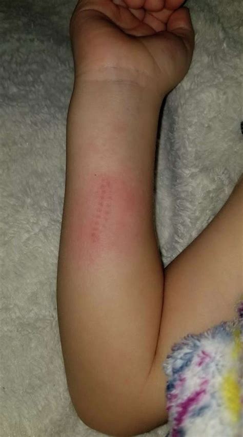 Everything you need to know about the venomous asp caterpillars in Houston