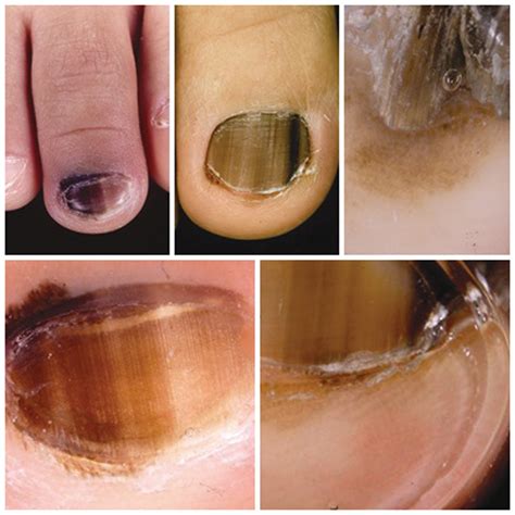 2013.1-33.EponymsH - Our Dermatology Online