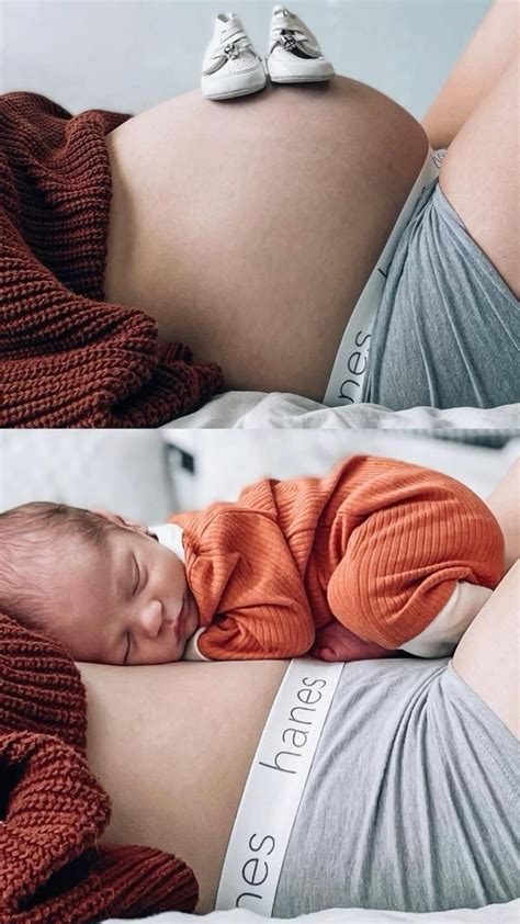 Puppp pregnancy rash itch remedies relief – Artofit