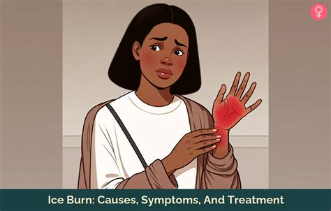 Ice Burn: Causes, Symptoms & 11 Home Treatment Tips