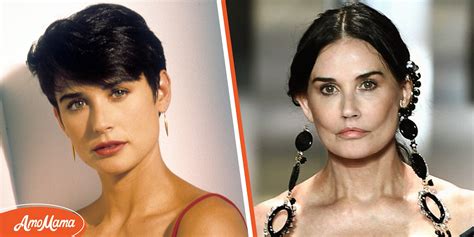 Did Demi Moore Get Plastic Surgery on Her Face? Experts Weighed In
