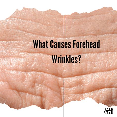 What Causes Forehead Wrinkles? - Skin Harmonics