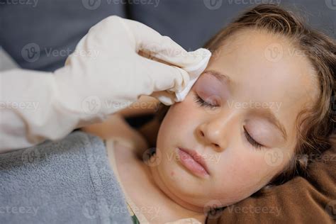 a small childhood infection on the eyelid caused by insect, mosquito or ...