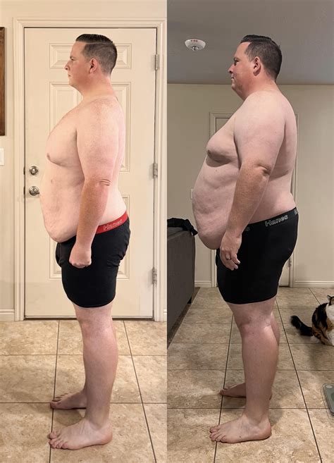 6 months post op. 108 pounds down. : r/gastricsleeve