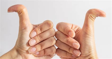 What does it mean to be double-jointed and is it harmful?