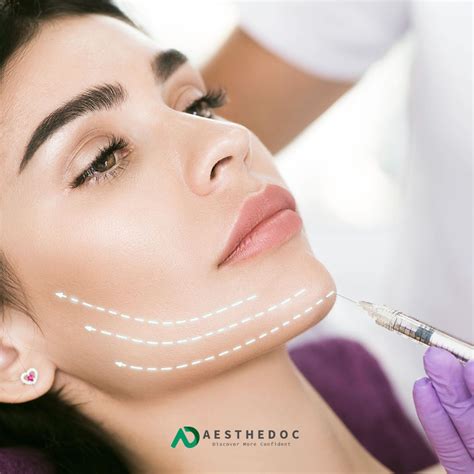 Facelift Surgery: Benefits, Procedure, Recovery Aesthedoc
