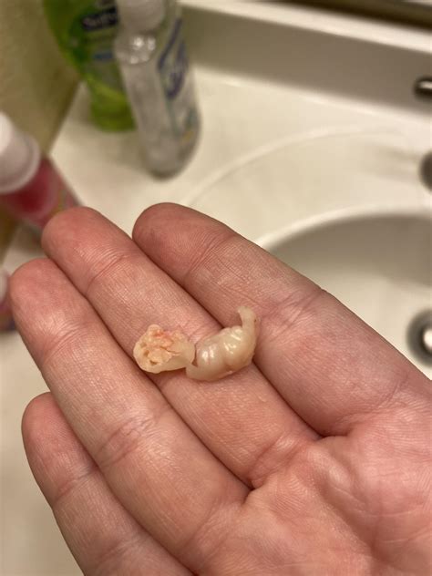 Can Dogs Get Pilar Cysts