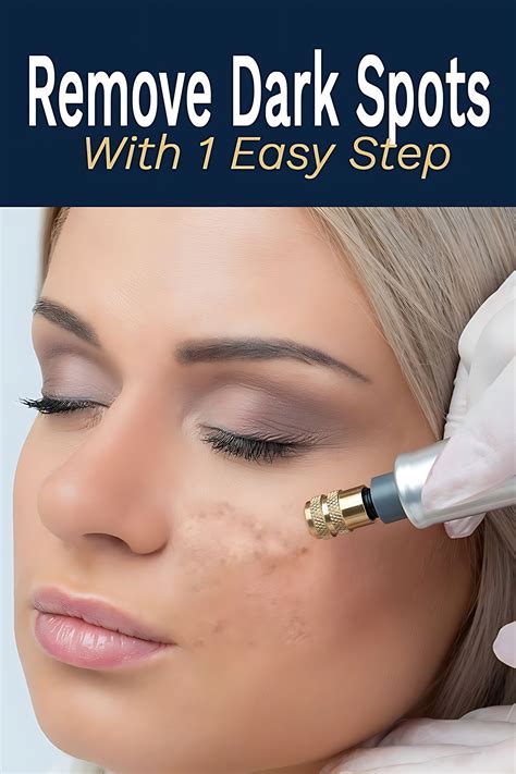 How Can I Remove Dark Spots on My Face Fast Naturally >>CHECK THIS OUT
