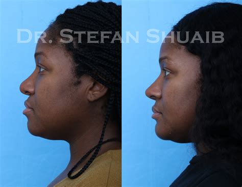 Plastic Surgery Clinic Rn at Katharine Gillis blog