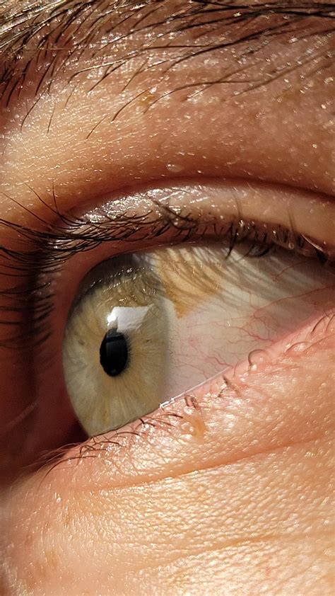 What Are The Brown Spots On My Eye at John Bing blog